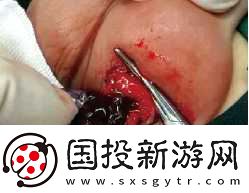 小女孩咬男生睪丸-小女孩調(diào)皮咬男生睪丸引發(fā)的奇趣故事