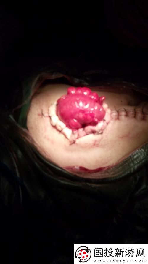 "痛點(diǎn)"里的狂潮-創(chuàng)新界的戲謔風(fēng)云