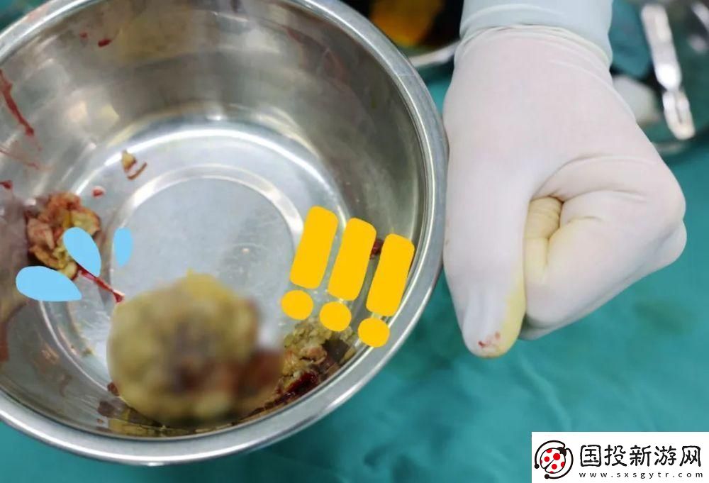 “腸”界翹楚-拳頭“新星”：游戲界的另類(lèi)傳奇